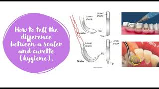 Difference between scaler and curette [upl. by Ellie]