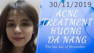 The last day of November  30112019  Acne treatment Hương Đà Nẵng [upl. by Amlez]