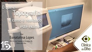 O que é Topografia e como é realizado o exame [upl. by Erny]