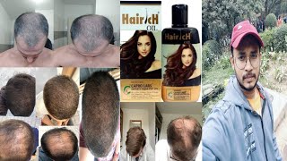 dont use capro hairich hair oil  honest review [upl. by Aiceled874]