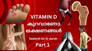 VitaminD deficiency Malayalam  less vitamind vitamind hairfallbody pain [upl. by Ahsemad726]