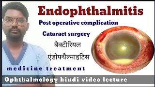 endophthalmitis  endophthalmitis treatment  endophthalmitis  endophthalmitis disease [upl. by Akerley816]