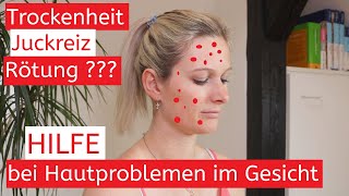 4K Rötung – Juckreiz – Trockenheit Das hilft bei Hautproblemen im Gesicht  Ursachen  Tipps [upl. by Concettina28]