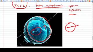 WHAT IS IVF  CONCEPT AND UNDERSTANDING [upl. by Kapor]