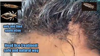 Head lice treatment safe and natural waykuto removalhome remedy remove head lice in a single day [upl. by Eahsed661]