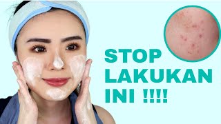 7 Kesalahan Mencuci Muka yg Bikin Jerawat Makin Parah dan Ga ilang INI PENYEBABNYA [upl. by Laven]