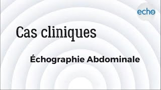 Échographie abdominale [upl. by Enelcaj]