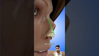 piercing beauty skincare satisfying nose nosejobs rhinoplastycost plasticsurgery rhinoplast [upl. by Enorel144]