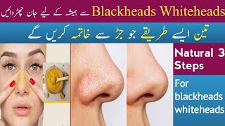 Home Remedies for Blackheads  Nose blackheads Remove  Get Clear Skin skincare blackheads [upl. by Ydasahc]