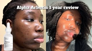 The Ordinary Alpha Arbutin 2  HA Updated Review 1 year later  Joselle [upl. by Longo296]