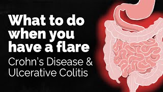 What to do if you have a Crohns disease or ulcerative colitis flare  GI Society [upl. by Donia]