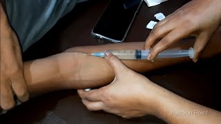 iv injection video iv Ceftriaxone 1g injection push 23 Ep27 Injection point [upl. by Ynatsed]