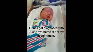 Lesson13 What is Duane Syndrome Baby E is 3 months old [upl. by Hahnke]