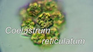 Coelastrum reticulatum [upl. by Nakasuji]