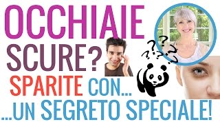 COME ELIMINARE le OCCHIAIE SCURE un SEGRETO SPECIALE per CONTORNO OCCHI e BORSE SCURE Parte 4 [upl. by Poore]