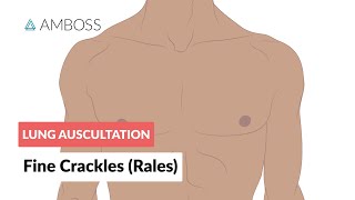 Fine Crackles Rales  Lung Auscultation  Episode 2 [upl. by Zetnod]