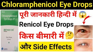 Renicol Eye Drops In HindiRenicol Eye Drops Use amp Side EffectsRenicol Eye Drops [upl. by Christian]