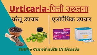 Urticariaपित्ती उछलना Allopathic treatments amp Home Remedies in Hindi II शीतपित्त का 100 इलाज I [upl. by Clava]