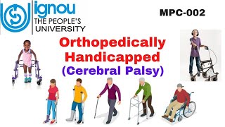 Orthopedically Handicapped MPC002 [upl. by Draper]