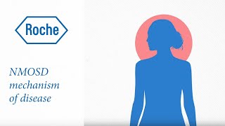 Neuromyelitis optica spectrum disorder  Mechanism of disease [upl. by Eissirc]