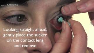 GP contact lens removal with sucker [upl. by Olimpia163]