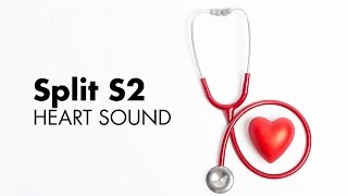 Fixed Split S2  Heart Sounds  MEDZCOOL [upl. by Klement]