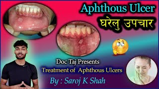 मुखमा अल्सर किन हुन्छ र घरेलु उपाय तथा उपचारहरु केके छन्  Aphthous Ulcer Treatment amp Home Remedies [upl. by Namhcan]