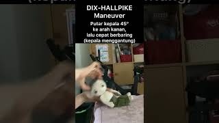 DixHallpike Manouvre drtirtawatiwijaya vertigo healthinfo informasikesehatan [upl. by Eihcra511]