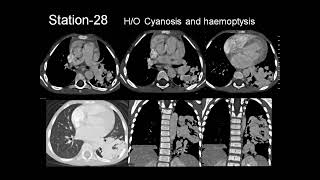 RADIOLOGY EXAM CASES [upl. by Nadabb367]