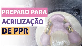 PREPARO PARA ACRILIZAÇÃO PPR  Beatriz Vieira [upl. by Heindrick]