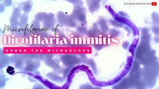 Microfilariae of Dirofilaria immitis under the microscope [upl. by Whitebook]