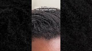 to all the postpartum moms out there with locs it will grow back 🌱 locs microlocs postpartum [upl. by Ginni810]