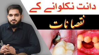 Side Effects of Tooth Extraction دانت نکلوانے کے نقصانات Urdu  Hindi drmuneermalik [upl. by Meelak459]