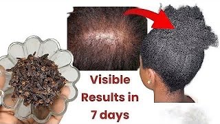 MASSIVE HAIR GROWTH in ONE MONTH with THIS Simple Trick [upl. by Eninahpets]