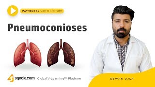 Pneumoconioses  Pathology Tutorials  Medical Education  VLearning  sqadiacom [upl. by Arimahs]