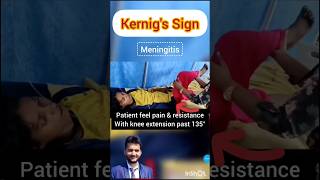 Kernigs sign meningitis shorts medical nursing NORCET [upl. by Tibbs]