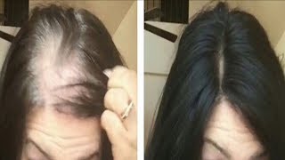 OMG SHOCKING Magic Hair Growth Serum  Reduce Hair fall [upl. by Aek]