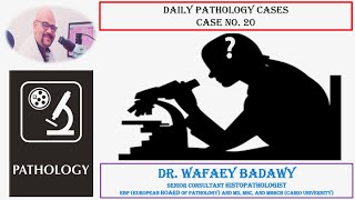 DAILY PATHOLOGY CASES CASE NO 20 BY DR WAFAEY BADAWY [upl. by Zosema]