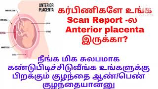 AnteriorAnterior placenta how to find baby gender in placenta anterior during pregnancy intamil [upl. by Dare]