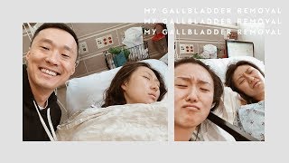 My Gallbladder Removal Experience [upl. by Aubert316]