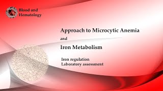 Approach To Microcytic Anemia [upl. by Irollam]