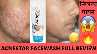 Acnestar Facewash Full review Effects and Side Effects Best for Acne क्या कील मुहासे होंगे गायब😃😰🤨🤨 [upl. by Naicad]