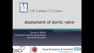 CT in Aortic Valve and TAVI [upl. by Aikcir]