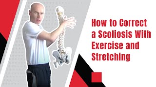 How to Correct a Scoliosis With Exercise and Stretching  Ed Paget [upl. by Montgomery572]