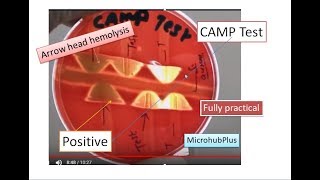 CAMP test CAMP Factor  CAMP Reaction  Microbiology Streptococcus agalactiae [upl. by Alema]