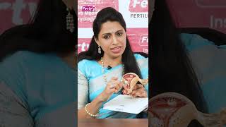 Best Time to Have Sx for Pregnancy  Best Fertility Center  Dr Jyothi  Ferty9 shorts [upl. by Ekez]