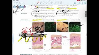 DERMATITIS HERPETIFORMISERYTHEMA MULTIFORMESTEVEN JOHNSON SYNDROME [upl. by Airual386]