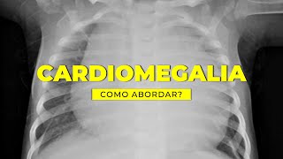 Todo aumento de área cardíaca é cardiomegalia [upl. by Eicarg]