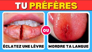 Tu préfères ÉCLATEZ UNE LÈVRE OU MORDRE TA LANGUE [upl. by Noyk]