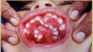 Top 10 Dangerous Dental Diseases You Wont Believe Really Exists [upl. by Yarised376]